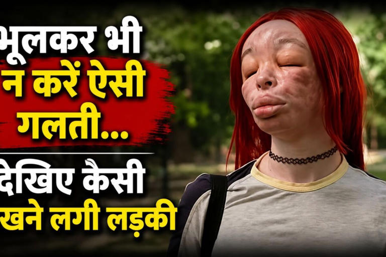 खूबसूरती का जानलेवा जुनून: घर पर ही खुद को नकली सिलिकॉन इंजेक्शन लगाने वाली युवती की दर्दनाक कहानी